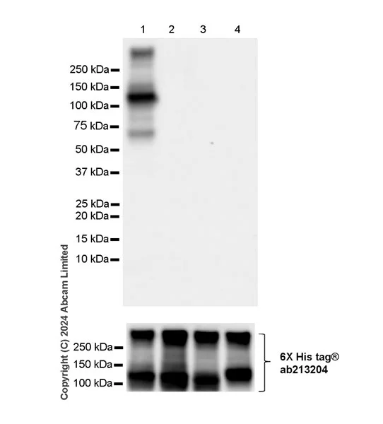Western blot - Anti-FGFR2IIIb/FGFR2b antibody [EPR30797-567] - BSA and Azide free (AB325965)