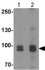 Western blot - Anti-FGFR3 antibody - C-terminal (AB180906)