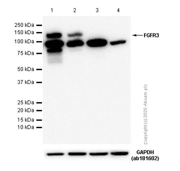 Western blot - Anti-FGFR3 antibody [EPR2304(3)] - BSA and Azide free (AB187341)