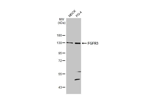 Western blot - Anti-FGFR3 antibody [HL1595] (AB308173)