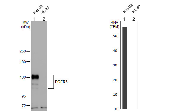 Western blot - Anti-FGFR3 antibody [HL1595] (AB308173), expandable thumbnail