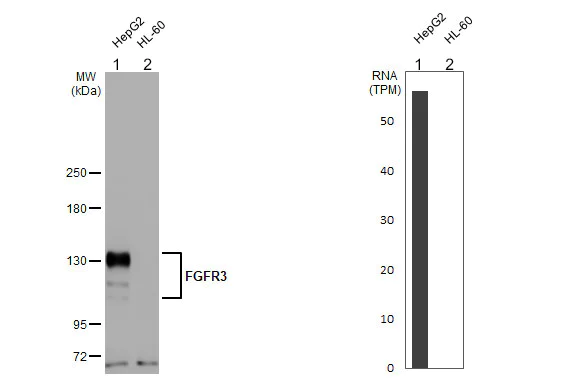 Western blot - Anti-FGFR3 antibody [HL1595] (AB308173)
