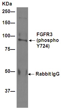 Immunoprecipitation - Anti-FGFR3 (phospho Y724) antibody [EPR2281(3)] (AB155960), expandable thumbnail