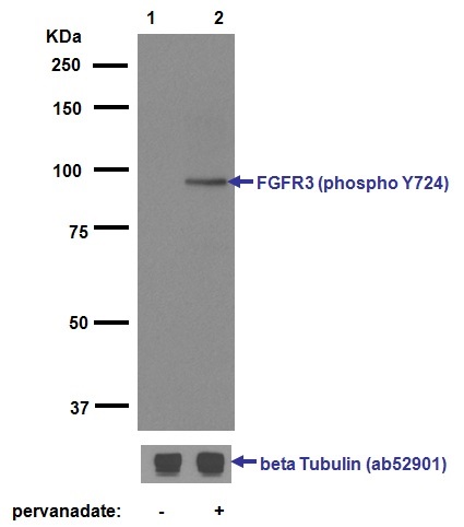 Western blot - Anti-FGFR3 (phospho Y724) antibody [EPR2281(3)] (AB155960), expandable thumbnail