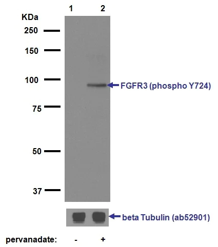 Western blot - Anti-FGFR3 (phospho Y724) antibody [EPR2281(3)] (AB155960)