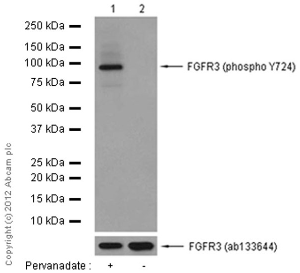Western blot - Anti-FGFR3 (phospho Y724) antibody [EPR2281(3)] (ab155960), expandable thumbnail