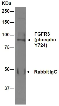 Immunoprecipitation - Anti-FGFR3 (phospho Y724) antibody [EPR2281(3)] - BSA and Azide free (AB271918)
