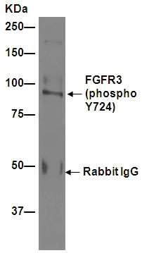 Immunoprecipitation - Anti-FGFR3 (phospho Y724) antibody [EPR2281(3)] - BSA and Azide free (AB271918)