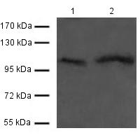 Western blot - Anti-FGFR4 antibody (AB119378), expandable thumbnail