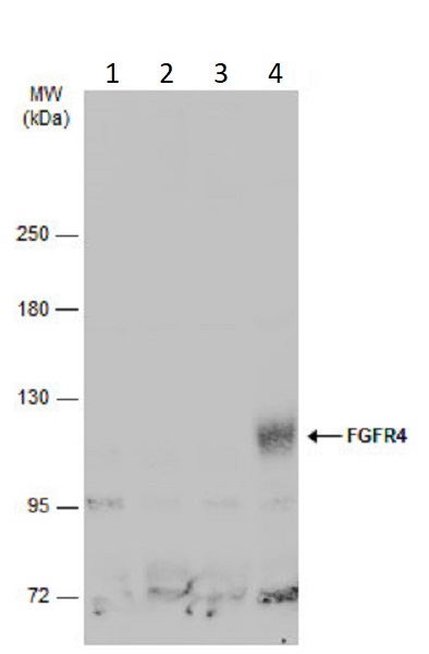 Western blot - Anti-FGFR4 antibody (AB262718)