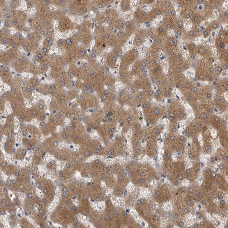 Immunohistochemistry (Formalin/PFA-fixed paraffin-embedded sections) - Anti-FGFR4 antibody (AB262839)