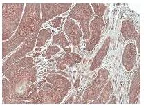 Immunohistochemistry (Formalin/PFA-fixed paraffin-embedded sections) - Anti-FGFRL1 antibody (AB95940)