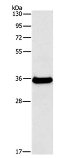 Western blot - Anti-FGL1 antibody (AB197357)