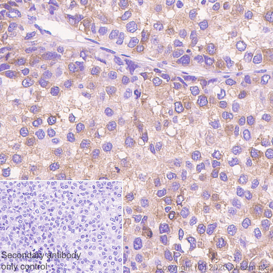 Immunohistochemistry (Formalin/PFA-fixed paraffin-embedded sections) - Anti-FGL1 antibody [EPR24018-27] (AB275091), expandable thumbnail
