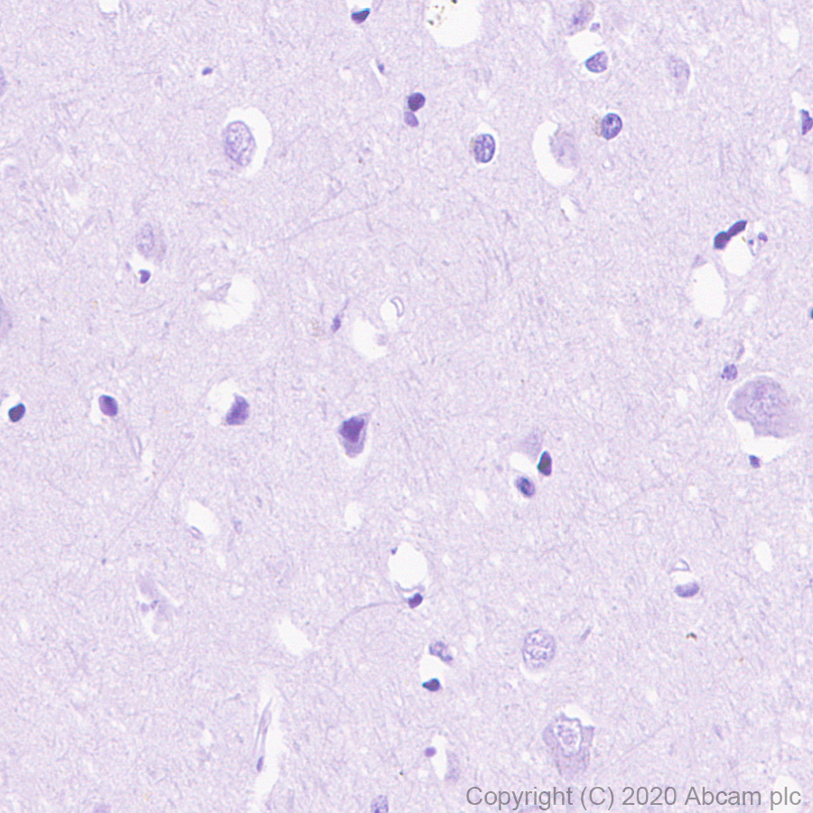 Immunohistochemistry (Formalin/PFA-fixed paraffin-embedded sections) - Anti-FGL1 antibody [EPR24018-27] (ab275091), expandable thumbnail