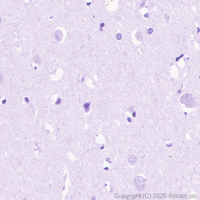 Immunohistochemistry (Formalin/PFA-fixed paraffin-embedded sections) - Anti-FGL1 antibody [EPR24018-27] (AB275091)