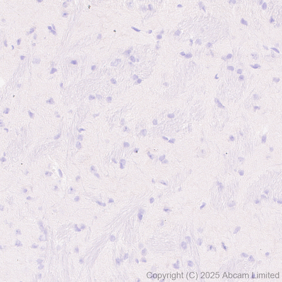Immunohistochemistry (Formalin/PFA-fixed paraffin-embedded sections) - Anti-FGL1 antibody [EPR29715-38] (AB324309), expandable thumbnail