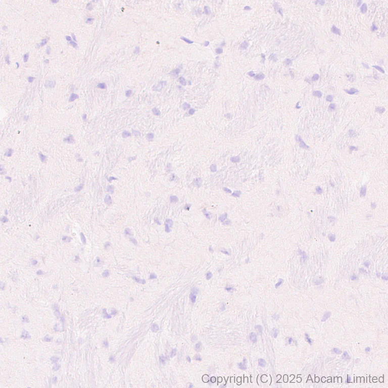 Immunohistochemistry (Formalin/PFA-fixed paraffin-embedded sections) - Anti-FGL1 antibody [EPR29715-38] (AB324309)