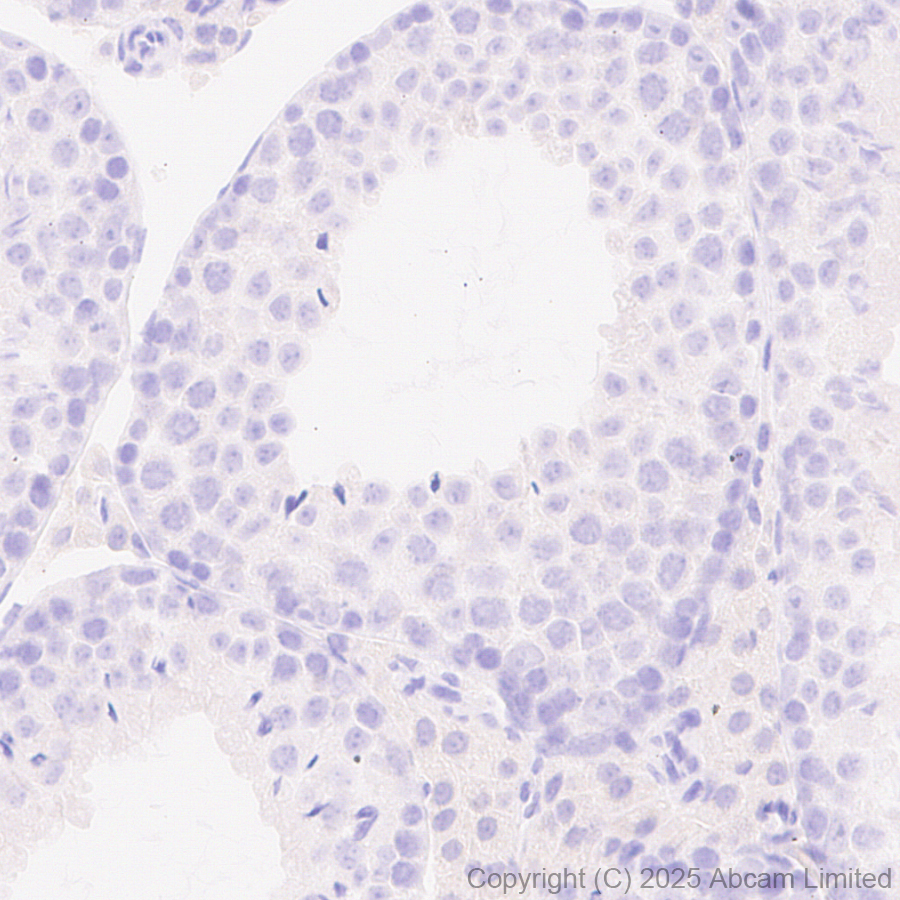 Immunohistochemistry (Formalin/PFA-fixed paraffin-embedded sections) - Anti-FGL1 antibody [EPR29715-38] (AB324309), expandable thumbnail