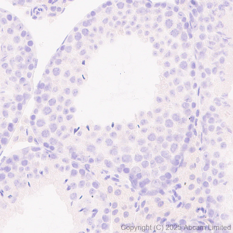 Immunohistochemistry (Formalin/PFA-fixed paraffin-embedded sections) - Anti-FGL1 antibody [EPR29715-38] (AB324309)