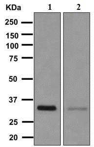 Western blot - Anti-FGL1 antibody [EPR9936] (AB168373)