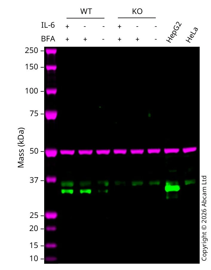 Western blot - Anti-FGL1 antibody [EPR9937] (AB170922)