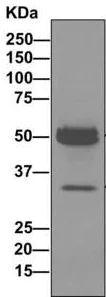 Immunoprecipitation - Anti-FGL1 antibody [EPR9937] - BSA and Azide free (AB249593)