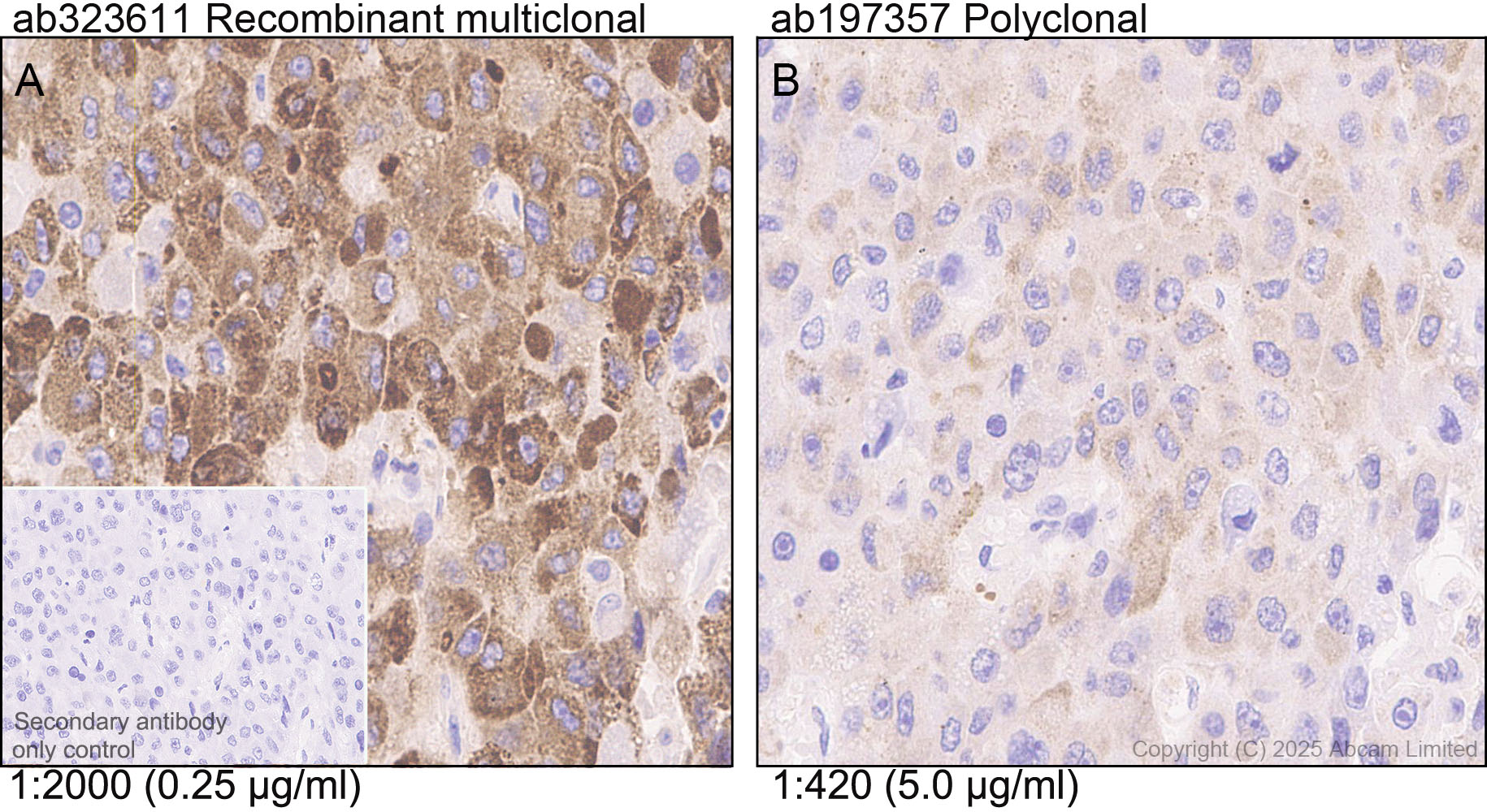 Immunohistochemistry (Formalin/PFA-fixed paraffin-embedded sections) - Anti-FGL1 antibody  [RM1297] (AB323611), expandable thumbnail