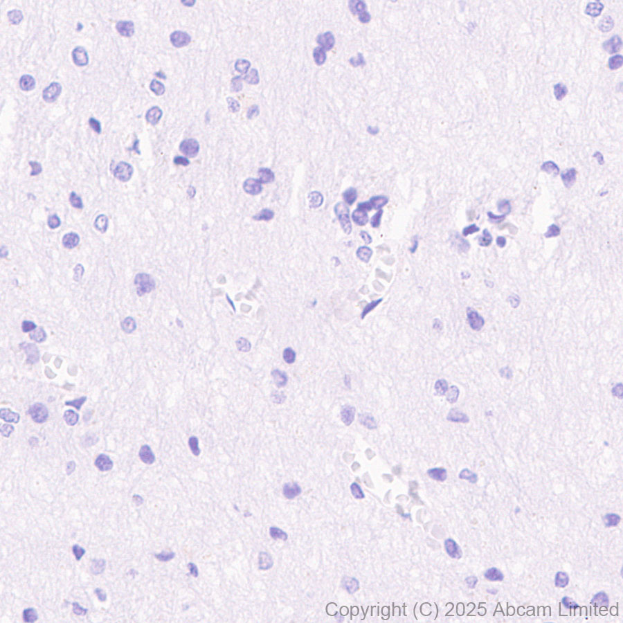 Immunohistochemistry (Formalin/PFA-fixed paraffin-embedded sections) - Anti-FGL1 antibody  [RM1297] (AB323611), expandable thumbnail