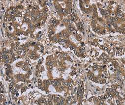 Immunohistochemistry (Formalin/PFA-fixed paraffin-embedded sections) - Anti-FGL2/Prothrombinase antibody (AB198029), expandable thumbnail