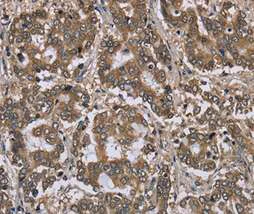 Immunohistochemistry (Formalin/PFA-fixed paraffin-embedded sections) - Anti-FGL2/Prothrombinase antibody (AB198029)