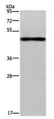 Western blot - Anti-FGL2/Prothrombinase antibody (AB198029), expandable thumbnail