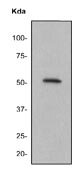 Western blot - Anti-FGR antibody [EPR3171] (AB133349)