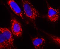 Immunocytochemistry/ Immunofluorescence - Anti-FH/Fumarase antibody [8F12BB5] (AB110286), expandable thumbnail