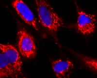 Immunocytochemistry/ Immunofluorescence - Anti-FH/Fumarase antibody [8F12BB5] (AB110286)