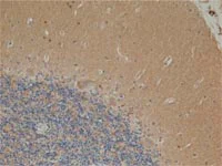 Immunohistochemistry (Formalin/PFA-fixed paraffin-embedded sections) - Anti-FH/Fumarase antibody [8F12BB5] (AB110286)