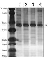 Immunoprecipitation - Anti-FH/Fumarase antibody [8F12BB5] (AB110286), expandable thumbnail
