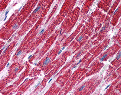 Immunohistochemistry (Formalin/PFA-fixed paraffin-embedded sections) - Anti-FH/Fumarase antibody (AB113963), expandable thumbnail