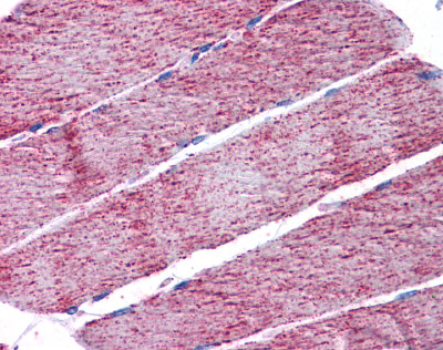 Immunohistochemistry (Formalin/PFA-fixed paraffin-embedded sections) - Anti-FH/Fumarase antibody (AB113963), expandable thumbnail