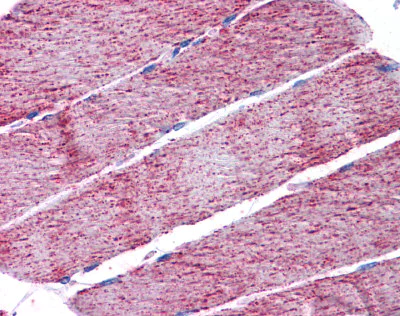 Immunohistochemistry (Formalin/PFA-fixed paraffin-embedded sections) - Anti-FH/Fumarase antibody (AB113963)