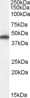 Western blot - Anti-FH/Fumarase antibody (AB113963), expandable thumbnail