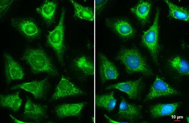 Immunocytochemistry/ Immunofluorescence - Anti-FH/Fumarase antibody (AB95947)