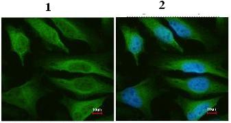Immunocytochemistry/ Immunofluorescence - Anti-FH/Fumarase antibody (AB95947), expandable thumbnail
