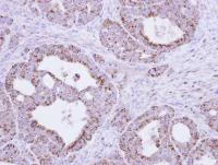 Immunohistochemistry (Formalin/PFA-fixed paraffin-embedded sections) - Anti-FH/Fumarase antibody (AB95947)