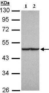 Western blot - Anti-FH/Fumarase antibody (AB95947), expandable thumbnail
