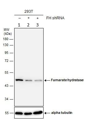 Western blot - Anti-FH/Fumarase antibody (AB95947)