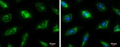 Immunocytochemistry/ Immunofluorescence - Anti-FH/Fumarase antibody (AB95950)