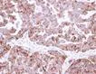 Immunohistochemistry (Formalin/PFA-fixed paraffin-embedded sections) - Anti-FH/Fumarase antibody (AB95950)