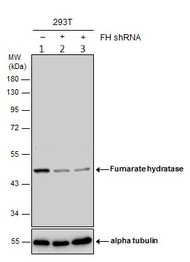 Western blot - Anti-FH/Fumarase antibody (AB95950)