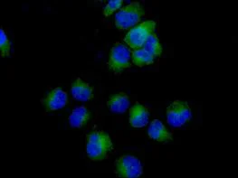 Immunocytochemistry/ Immunofluorescence - Anti-FH/Fumarase antibody [EPR11647(2)(B)] - N-terminal (AB184945)